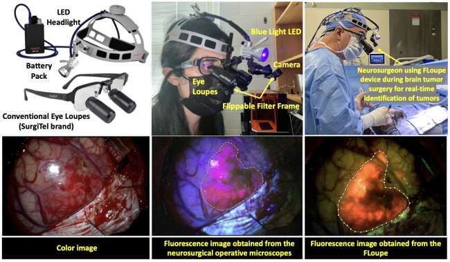 A Wearable Fluorescence Imaging Device for Intraoperative Identification of Human Brain Tumors graphical abstract